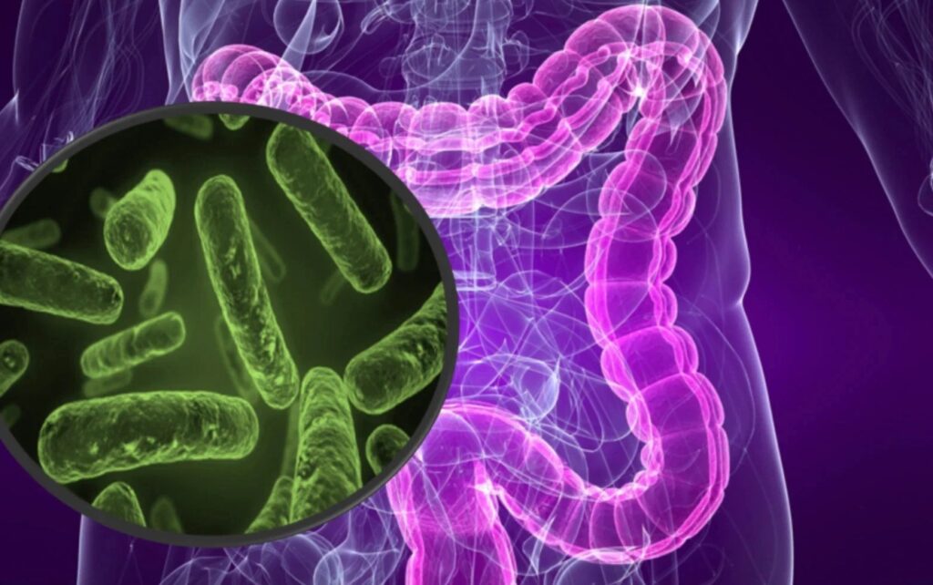 How Gut Microflora Is Destroyed. The gut microbiome is like a tropical forest. Remove a few key species, and the whole system starts falling apart. Image source: winbiota.com. How Gut Microflora Is Destroyed. The gut microbiome is like a tropical forest. Remove a few key species, and the whole system starts falling apart. Image source: winbiota.com. Photo.