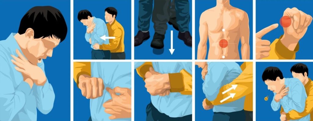 How to Perform the Heimlich Maneuver. How to perform the Heimlich maneuver illustrated. Source: squarespace.com. How to Perform the Heimlich Maneuver. How to perform the Heimlich maneuver illustrated. Source: squarespace.com. Photo.