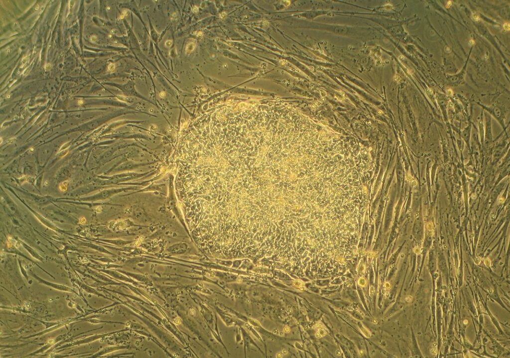 Human embryonic stem cells. Image source: wikimedia.org