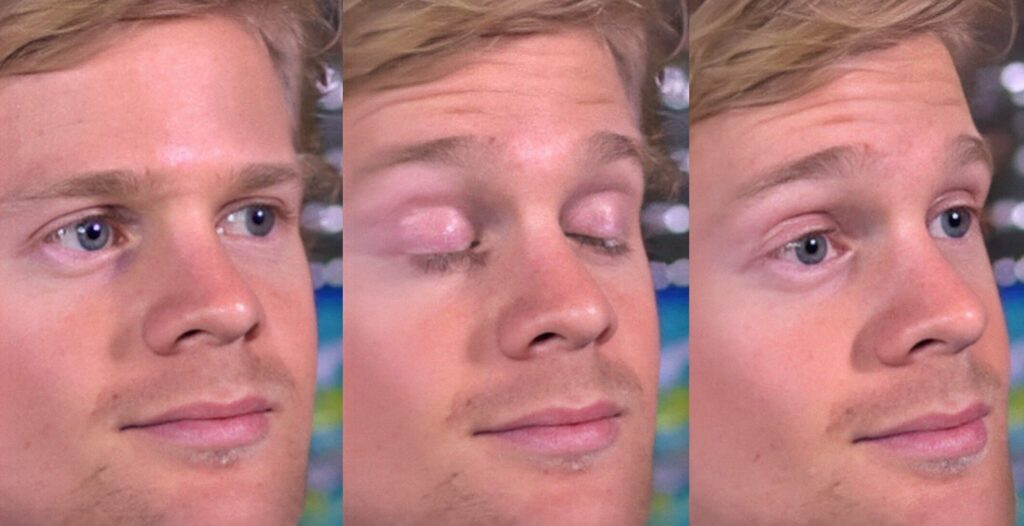 Why don't we notice when we blink? Over 80 years of life, a person spends an average of 3.5 years just blinking. Photo.
