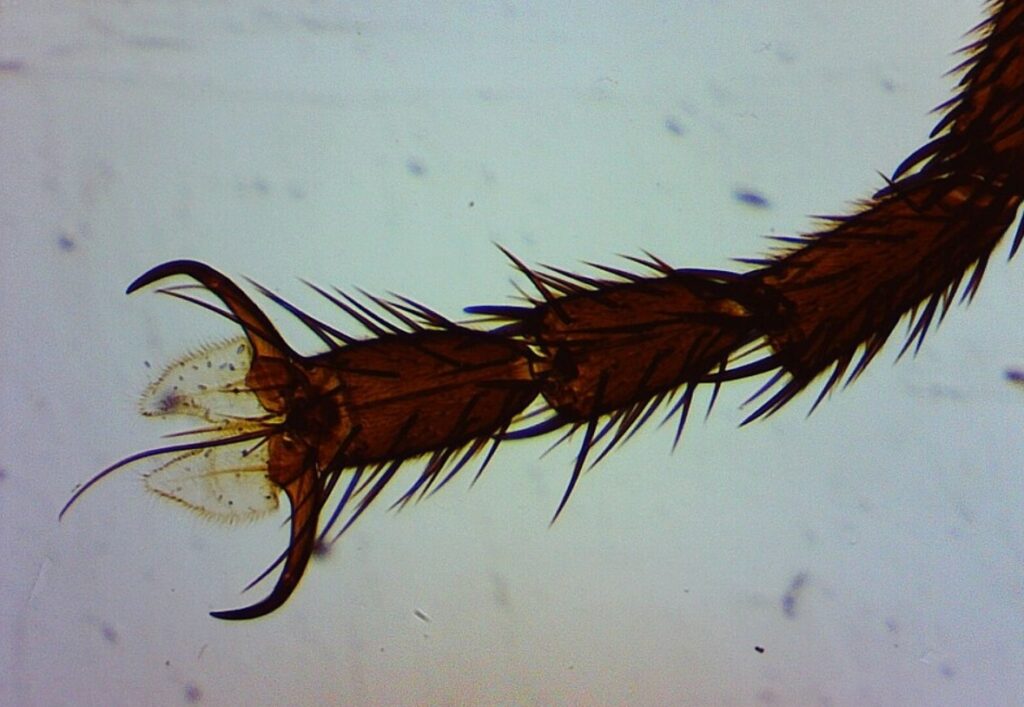Why Flies Clean Themselves So Often. A fly's leg under a microscope. Image source: wikimedia.org. Photo.
