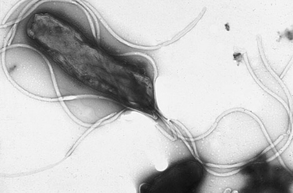 Who is Barry Marshall and what he found in the stomach. The bacterium Helicobacter pylori under a microscope. Image source: wikimedia.org. Photo.