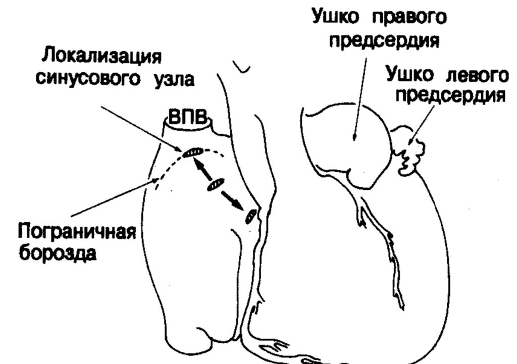 Where the left atrial appendage is located. Image source: studfile.net. Photo.