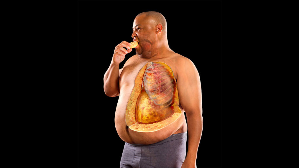 Excess weight: cause or consequence. More than one billion people worldwide suffer from obesity. Excess weight: cause or consequence. More than one billion people worldwide suffer from obesity. Photo.
