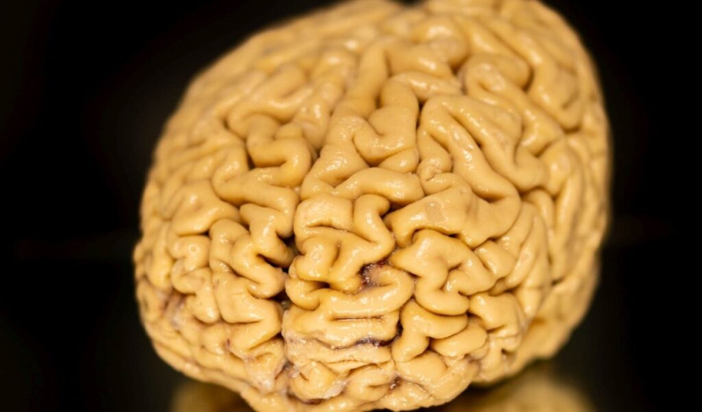 Superagers' brains are donated to science voluntarily. It is precisely thanks to such donations that this discovery was made. Image source: sciencealert.com