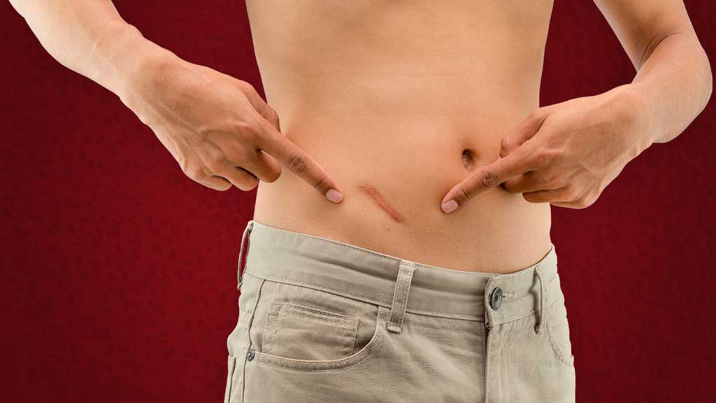 Why You Have an Appendix and Why It Was Wrongly Considered Useless. The appendix: a relic of the past and a useless organ, or do we actually need it? Image source: ausmed.com.au. Why You Have an Appendix and Why It Was Wrongly Considered Useless. The appendix: a relic of the past and a useless organ, or do we actually need it? Image source: ausmed.com.au. Photo.