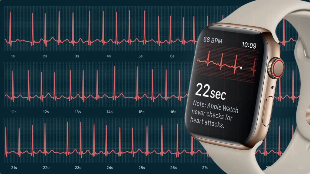 ECG on Apple Watch from Dubai. ECG will also record without issues. Photo.