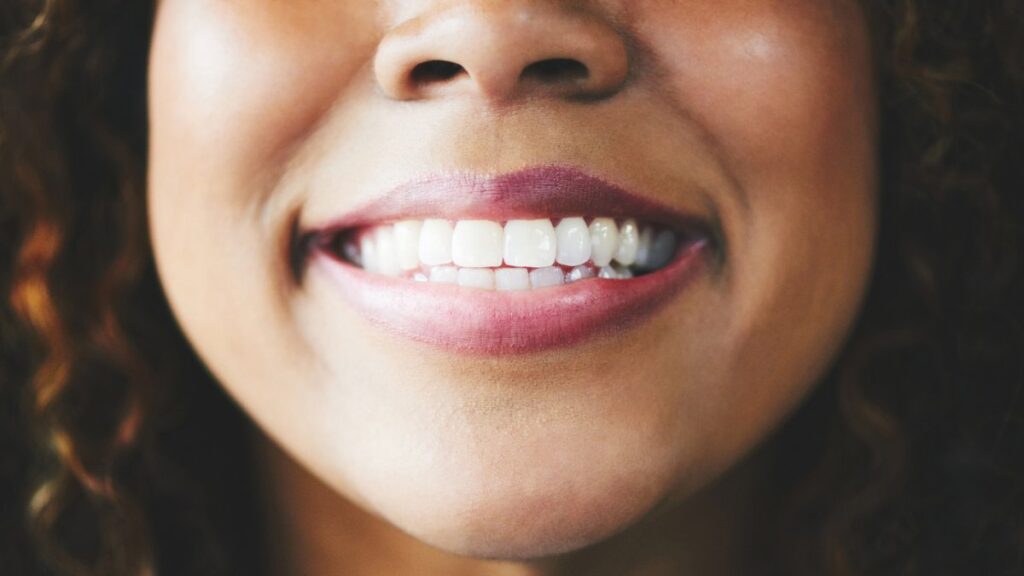 White teeth are not always an indicator of health. Photo.