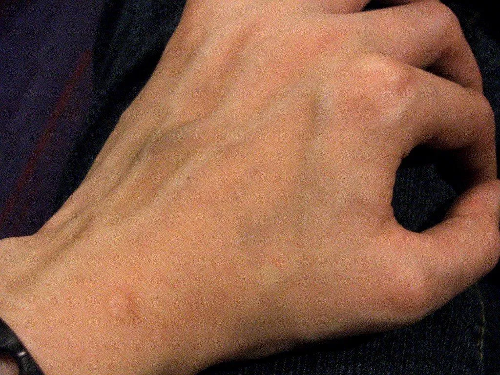 Venous blood in a test tube is dark red, not blue at all