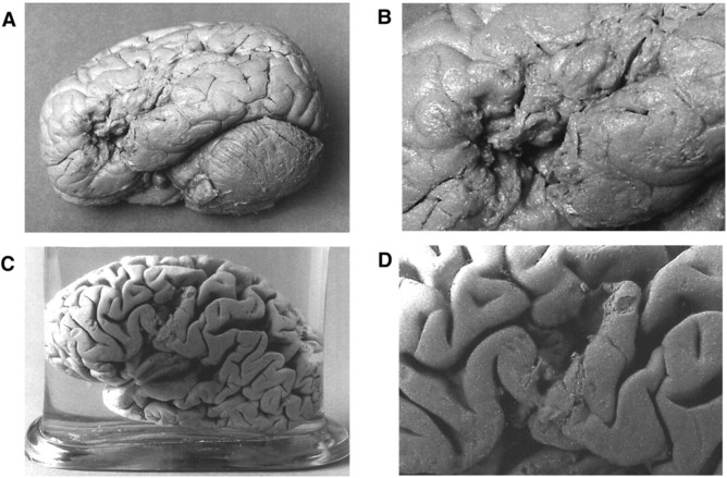Brains of Paul Broca's famous patients: Leborgne (A,B) and Lelong (C,D). Image source: 22century.ru. Photo.