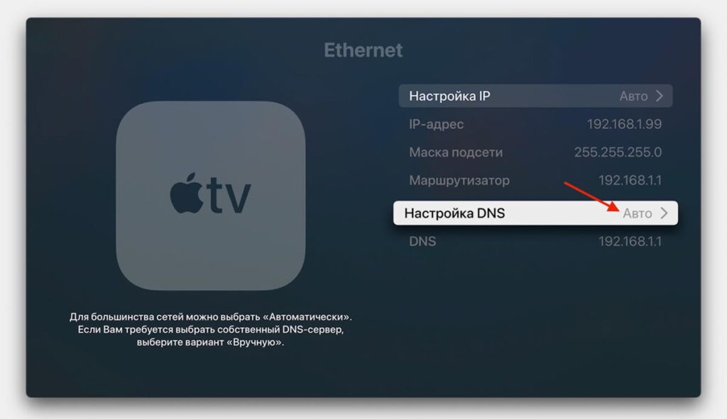 Kinopub on Apple TV 3 — DNS and profile setup. First you need to complete the DNS setup. Image: iphones.ru. Photo.