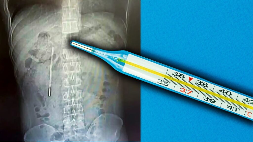 The Chinese resident had no idea there was a thermometer inside him. Image source: dexerto.com. Photo.