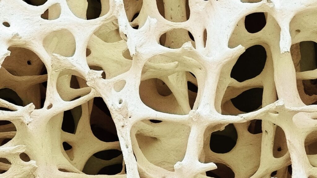 40% of adults have a hidden diagnosis that could lead to serious health problems in the future. Photo.