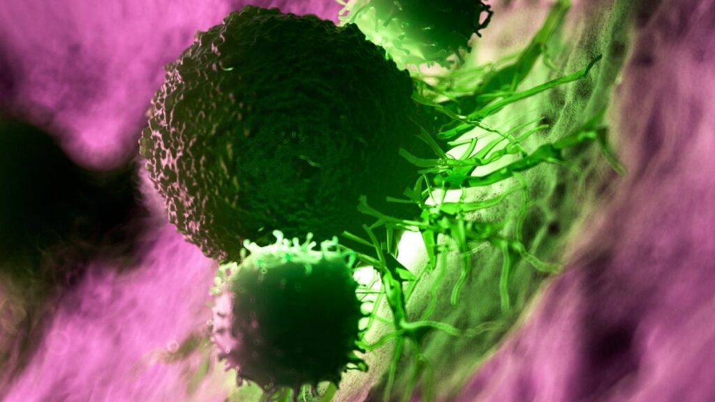A vaccine against pancreatic cancer has shown very promising results. Photo.