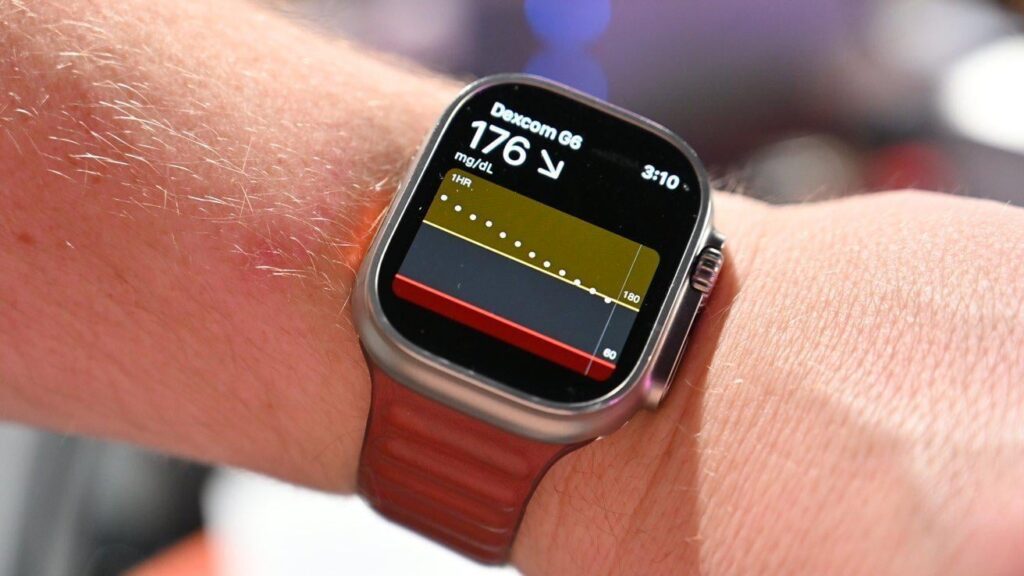 Will Apple Watch get non-invasive blood sugar measurement. A non-invasive glucometer is definitely not worth waiting for. Photo.