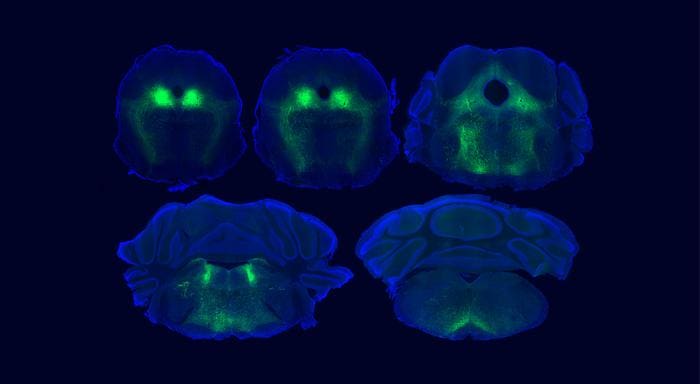 Fluorescent images of the key brain structure involved in placebo pain relief in mice. Green color — neurons regulating pain sensations. Photo.