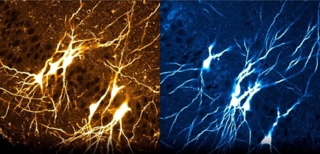 Left: the hippocampus of a young mouse is a dense neural network. Right: as the mouse matures, this network is reduced. Photo.