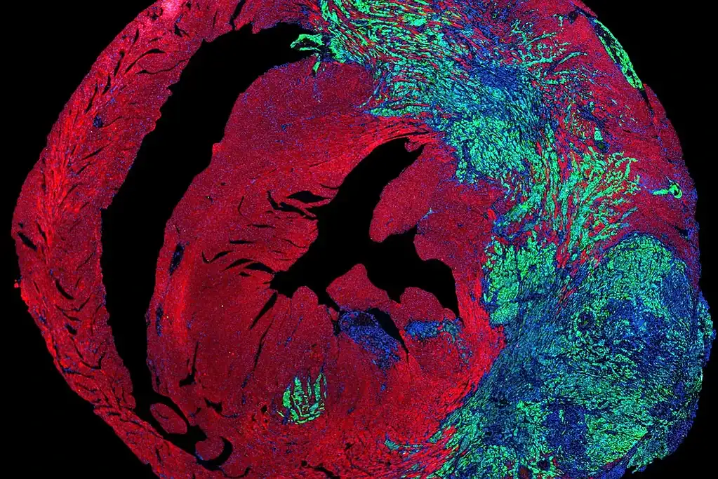 Lung cancer cells (green) growing in a mouse heart. Photo.