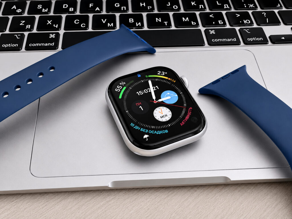 Where to buy affordable bands for Apple Watch. There are tons of bands for Apple Watch to suit any taste. Photo.