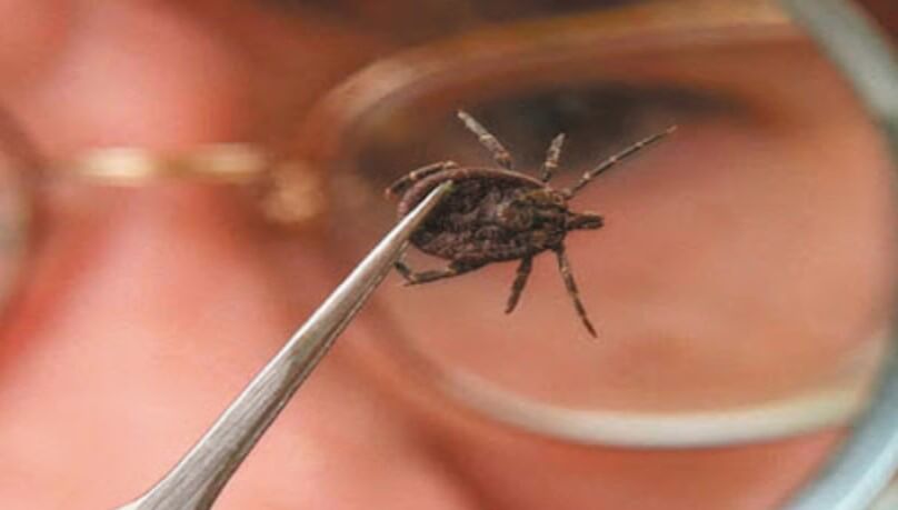 There is still no effective cure for encephalitis. Photo.