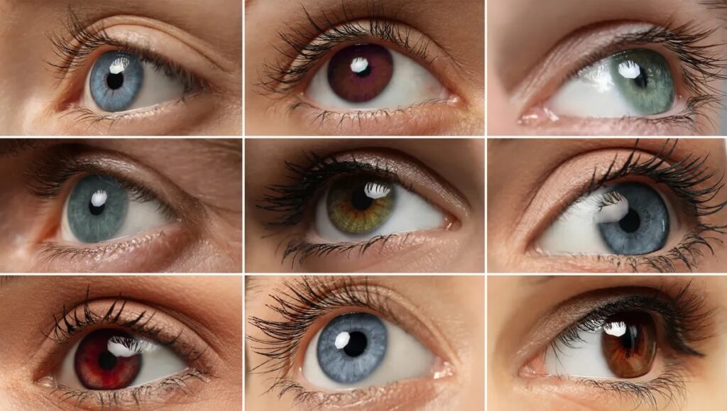 Eye color can change more often than we think, but not all causes are harmless. Photo.