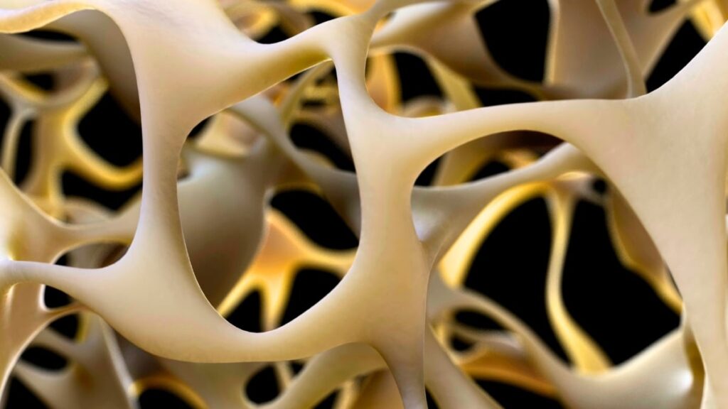 A Revolutionary Way to Strengthen Bones: How to Defeat Osteoporosis Once and for All