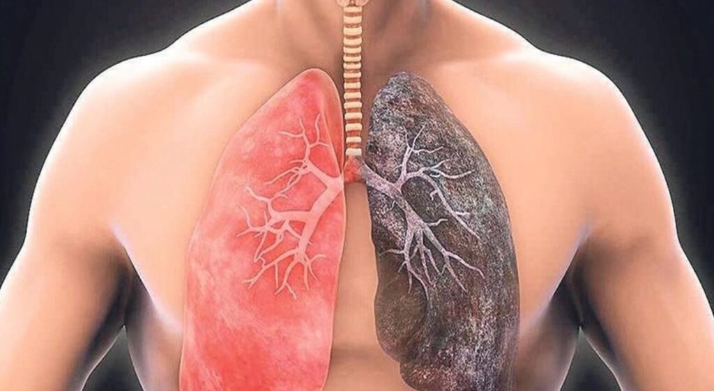When inhaling underwater, fluid enters the airways and causes coughing. Photo.