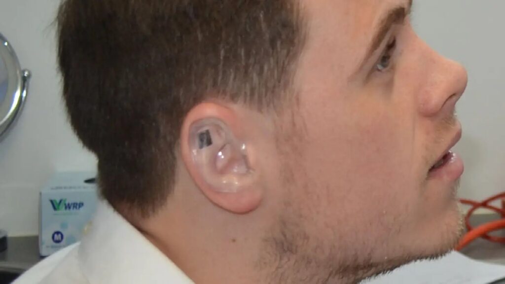 A man with cauliflower ear prevention. Photo.