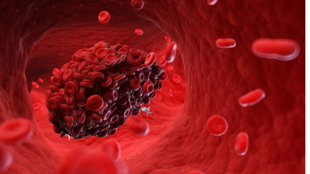 Stress increases the production of highly reactive molecules known as free radicals. These molecules alter the clot formation process.