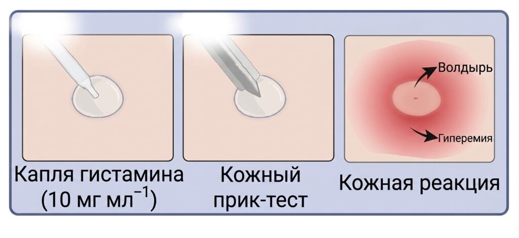 Diagram of the histamine skin-prick test procedure.