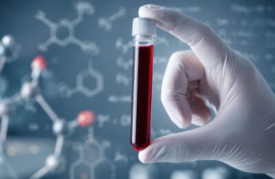 Blood of supercentenarians reveals unusual immune cells that may fight hidden cancers